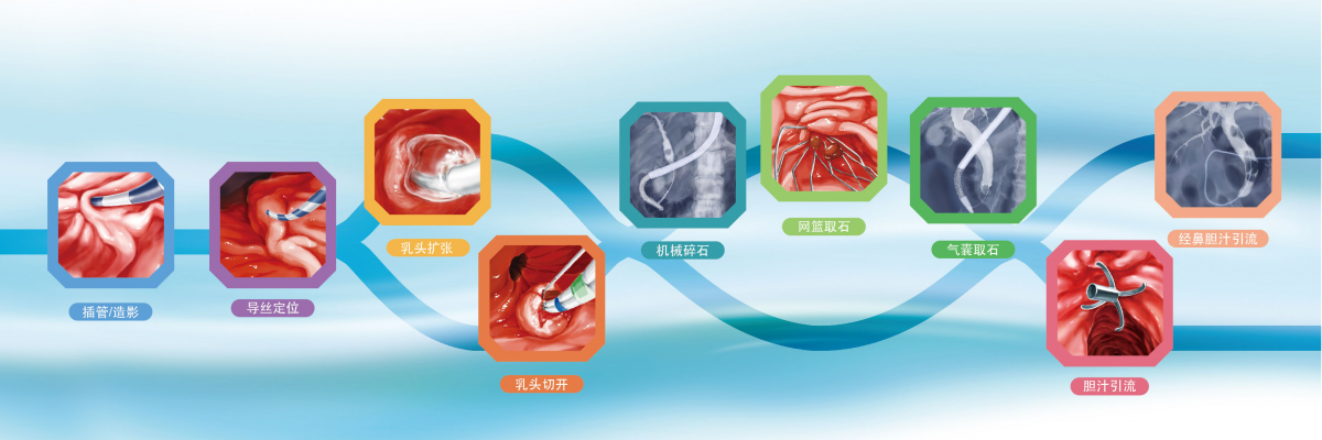 cd33檢測(cè)試劑（cd33-percp-cy5.5）