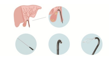 纖維膽道內(nèi)鏡系列