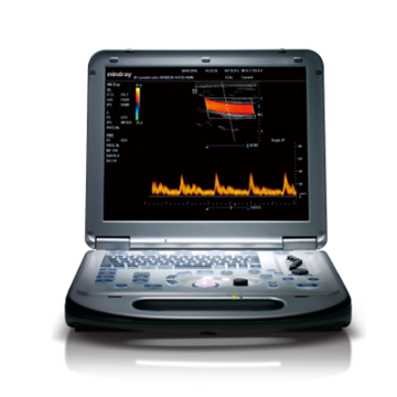 邁瑞mindray 便攜式彩色多普勒超聲系統(tǒng) m55(主機+線陣+腹部+相控陣)