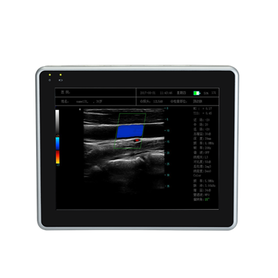 平板式全數(shù)字彩色多普勒超聲診斷系統(tǒng)meye1