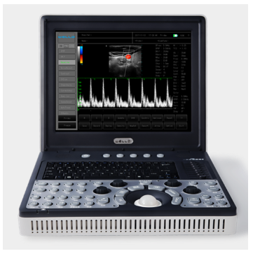 便攜式全數字彩色多普勒超聲診斷系統d3