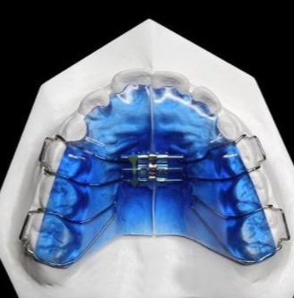 華偉定制式矯治器擴弓型、矯治保持型、牙膠片型