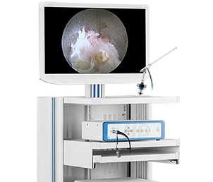 冠龍醫(yī)用內窺鏡攝像系統(tǒng)ys-i