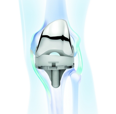 強生全膝關節系統