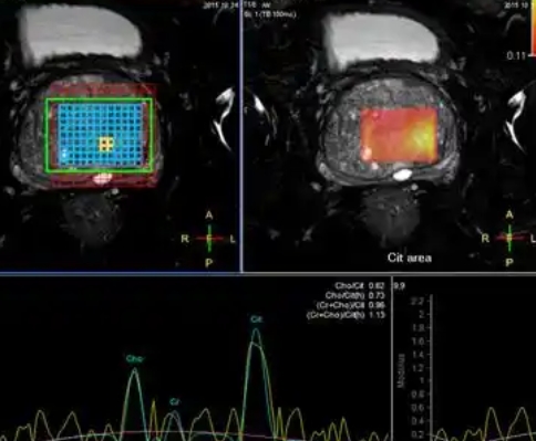 前列腺mri醫學影像存儲傳輸與處理軟件