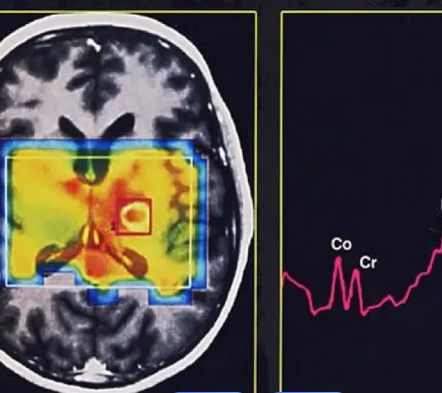 磁共振成像系統mri system