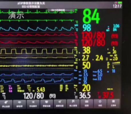 心臟遠程移動監(jiān)護系統