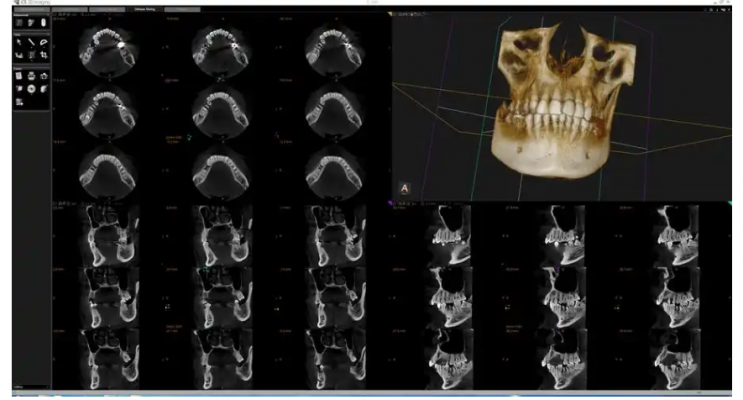 牙科影像存儲與傳輸系統軟件dtx studiotm core